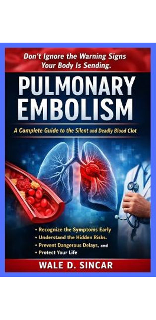 "Pulmonary Embolism