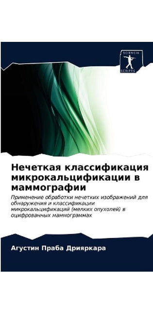 Нечеткая классификация микрокальцифика&