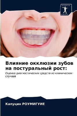 Влияние окклюзии зубов на постуральный рl