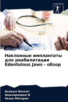 Наклонные имплантаты для реабилитации Edentulous Ja