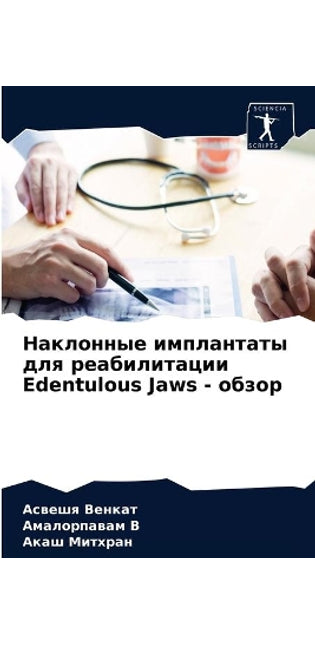 Наклонные имплантаты для реабилитации Edentulous Ja