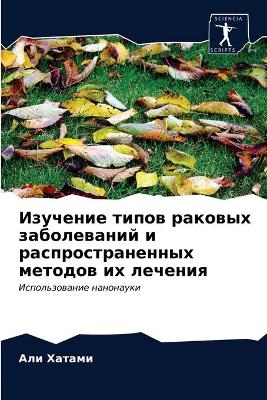 Изучение типов раковых заболеваний и расl