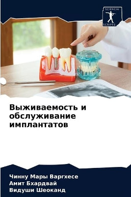 Выживаемость и обслуживание имплантатов