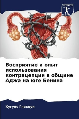 Восприятие и опыт использования контраце