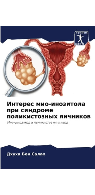 Интерес мио-инозитола при синдроме поликl