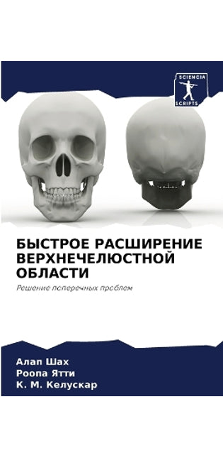 БЫСТРОЕ РАСШИРЕНИЕ ВЕРХНЕЧЕЛЮСТНОЙ ОБЛА