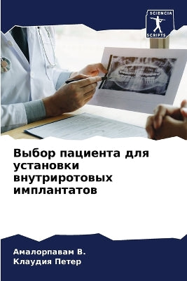 Выбор пациента для установки внутриротов