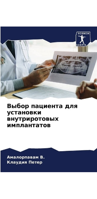 Выбор пациента для установки внутриротов