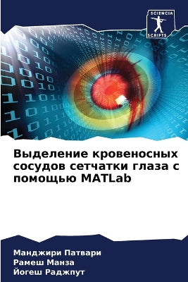 Выделение кровеносных сосудов сетчатки г