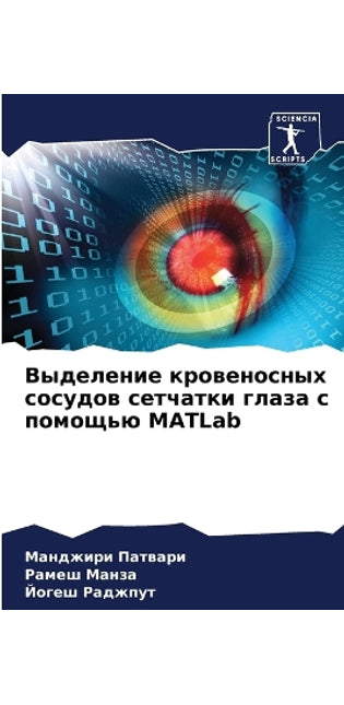 Выделение кровеносных сосудов сетчатки г