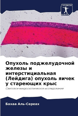Опухоль поджелудочной железы и интерстиц
