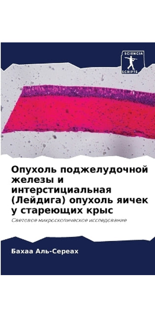 Опухоль поджелудочной железы и интерстиц