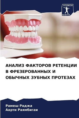 АНАЛИЗ ФАКТОРОВ РЕТЕНЦИИ В ФРЕЗЕРОВАННЫХ