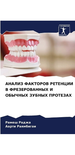 АНАЛИЗ ФАКТОРОВ РЕТЕНЦИИ В ФРЕЗЕРОВАННЫХ
