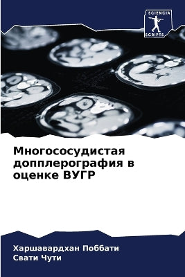 Многососудистая допплерография в оценке
