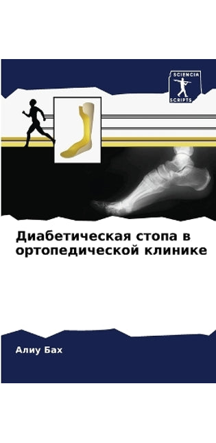 Диабетическая стопа в ортопедической кли