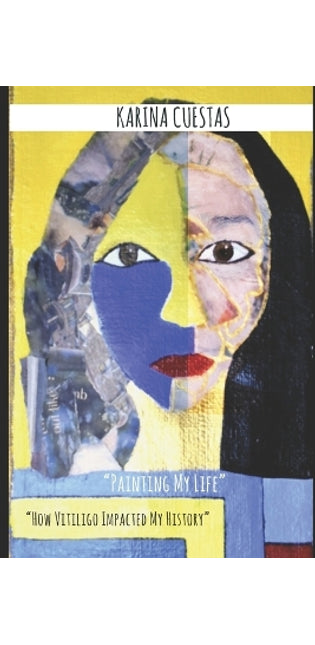 " Painting My Life" " How Vitiligo Impacted my history."
