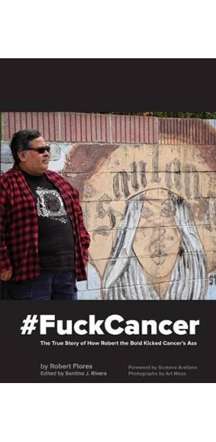 #fuckcancer the True Story of How Robert the Bold Kicked Cancer's Ass