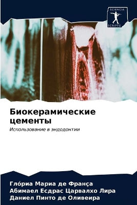 Биокерамические цементы