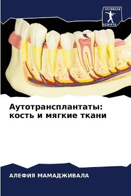 Аутотрансплантаты