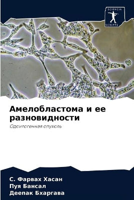 Амелобластома и ее разновидности