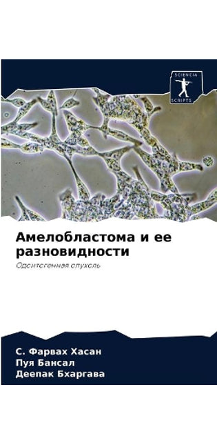Амелобластома и ее разновидности