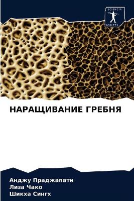 НАРАЩИВАНИЕ ГРЕБНЯ