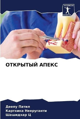 ОТКРЫТЫЙ АПЕКС