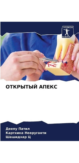 ОТКРЫТЫЙ АПЕКС