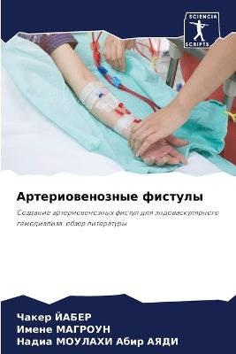 Артериовенозные фистулы