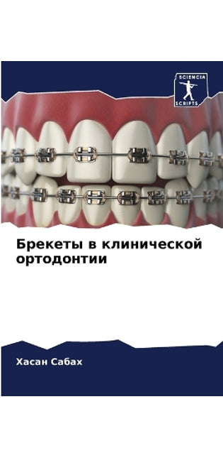 Брекеты в клинической ортодонтии