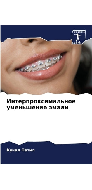 Интерпроксимальное уменьшение эмали