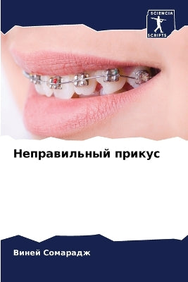 Неправильный прикус