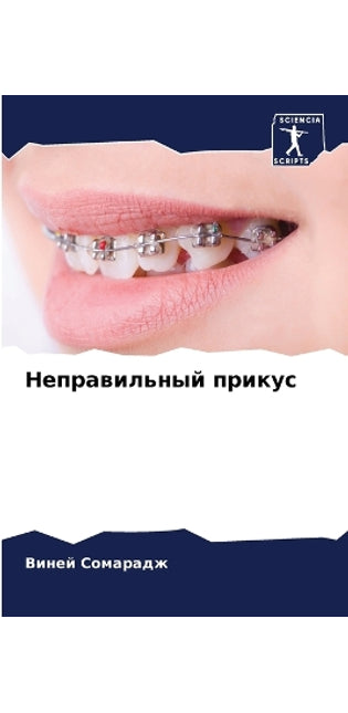 Неправильный прикус