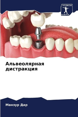 Альвеолярная дистракция