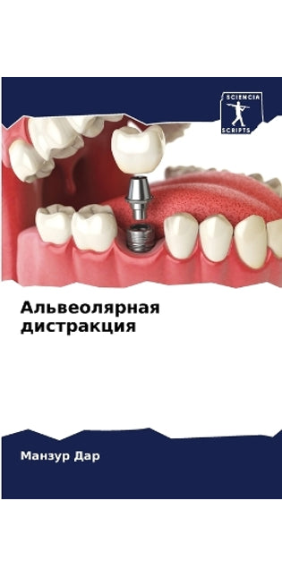 Альвеолярная дистракция