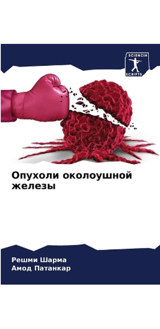 Опухоли околоушной железы