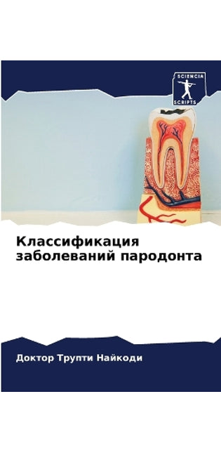 Классификация заболеваний пародонта