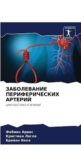 ЗАБОЛЕВАНИЕ ПЕРИФЕРИЧЕСКИХ АРТЕРИЙ